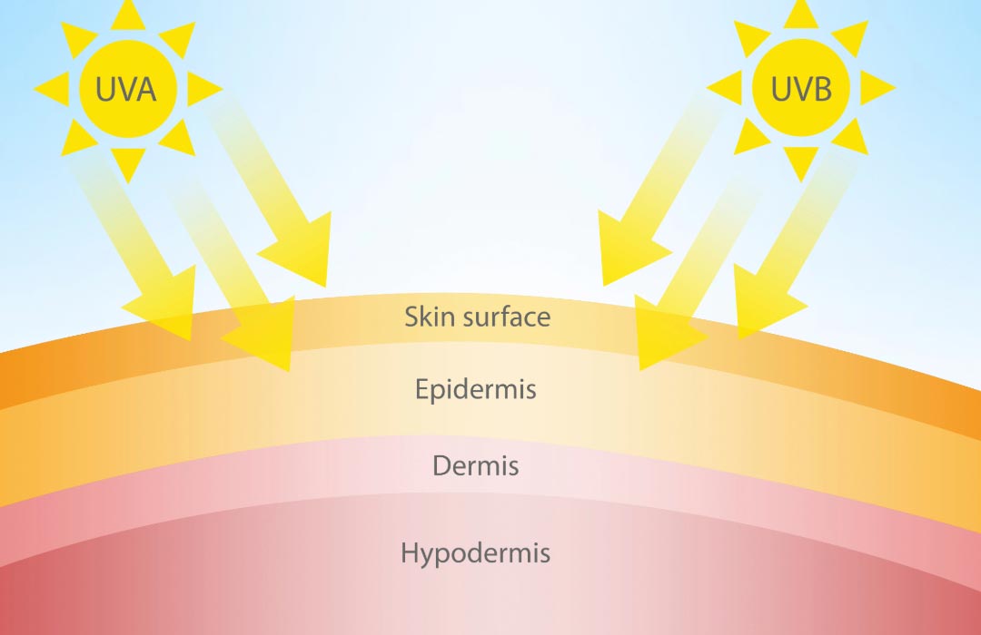 An image showing the different skin layers, epidermis, dermis and hypodermis